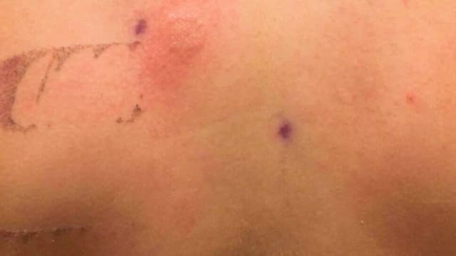 Jak rozpoznać nikiel w kosmetykach i uniknąć alergii – oznaczenia INCI
